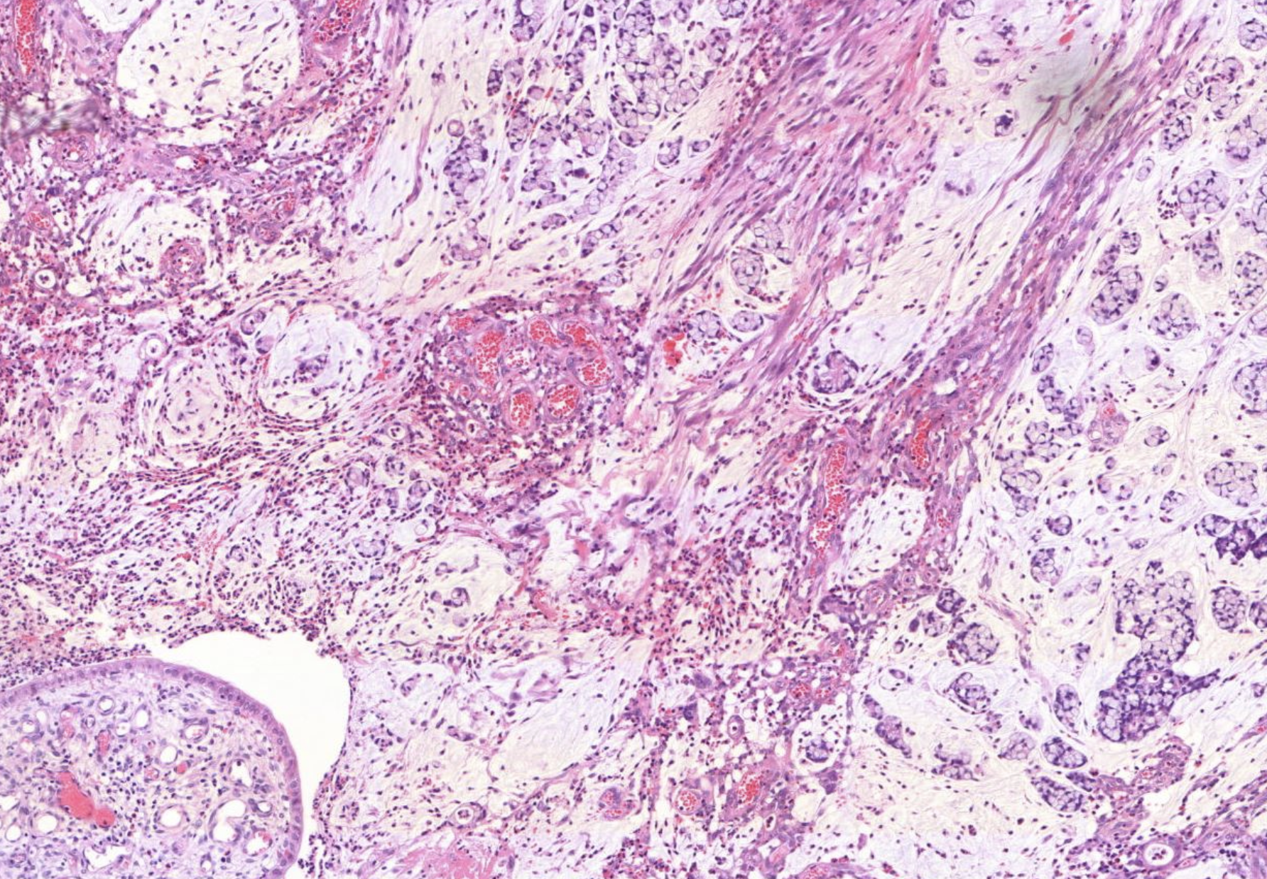 Histopathologisches Bild: Kolonschleimhaut